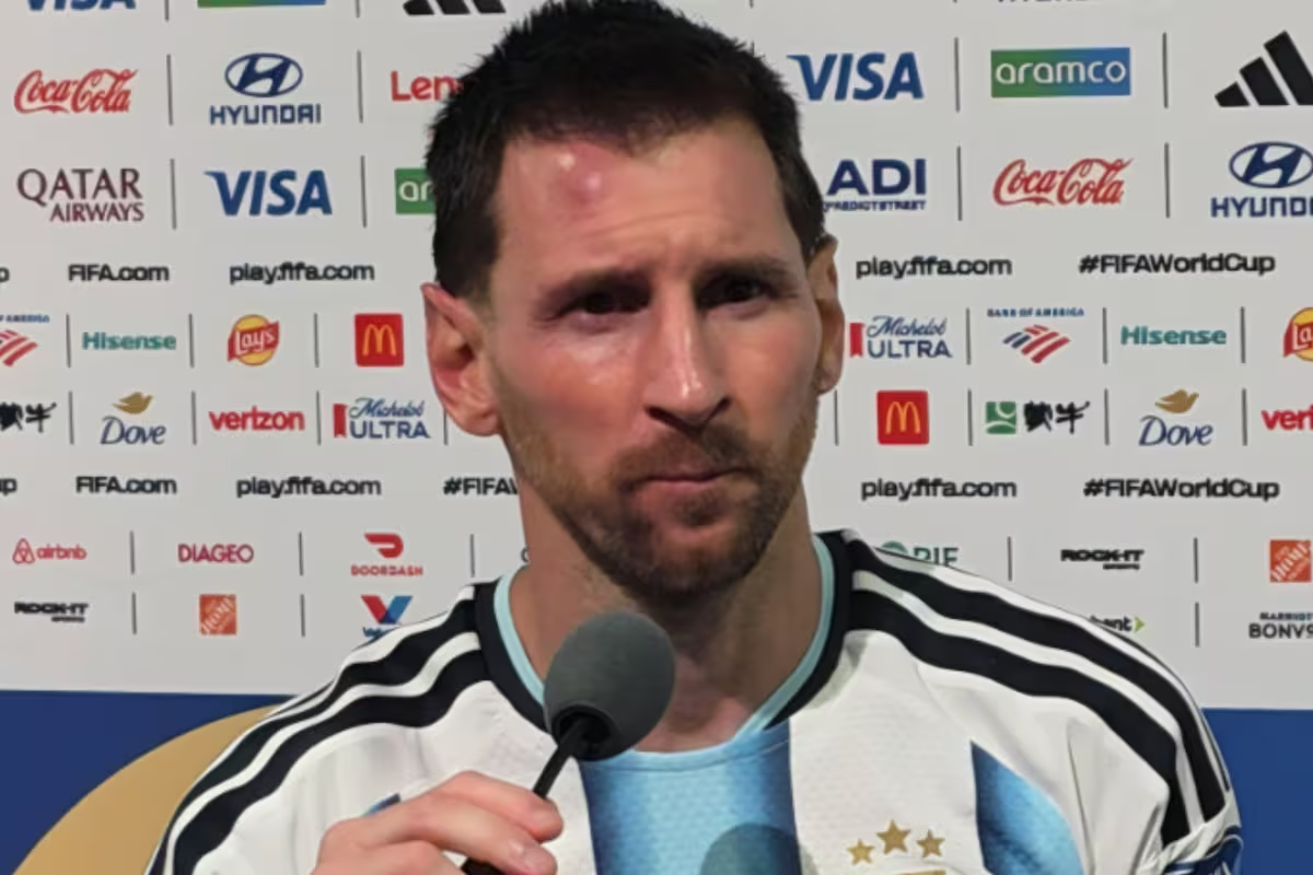 el-chichon-de-messi-tras-el-partido-ante-cabo-OHFXCHOLEJHD5BJFHLQNKZZ5QQ